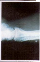 implantes-extraterrestres2