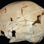 Los antepasados de los Neandertales, cuidaban a sus familiares con enfermedades psíquicas. 