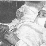 Leoniv Rogozov, el medico que se operó a sí mismo.