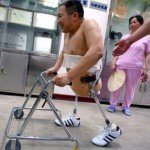 Peng Shulin, el hombre milagro y la bio-robotica.