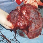 El menú de esta noche: Placenta.